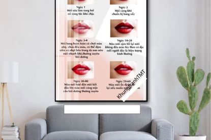 🖼️ KHUNG TRANH QUY TRÌNH PHỤC HỒI MÔI