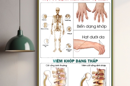 🔎 PHÒNG Y CỦA ANH/CHỊ ĐÃ TRANG BỊ MỘT SỐ HÌNH ẢNH ĐIỀU TRỊ VIÊM KHỚP CHƯA?
