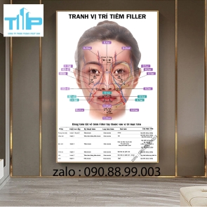Khung tranh tráng gương  tiêm filler botox