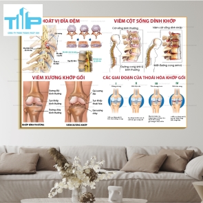 Khung tranh các bệnh về cơ xương khớp thường gặp P1