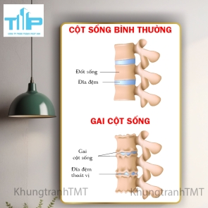 Tranh huyệt đạo đầu và cổ 