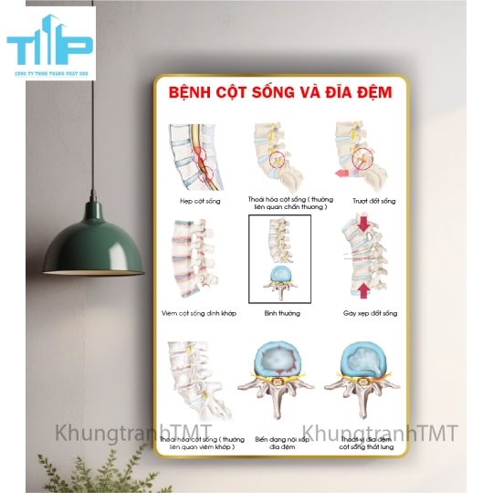 Tranh huyệt đạo đầu và cổ 