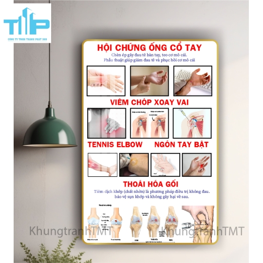 tranh huyệt đạo tráng gương dành cho spa, thẩm mỹ viện