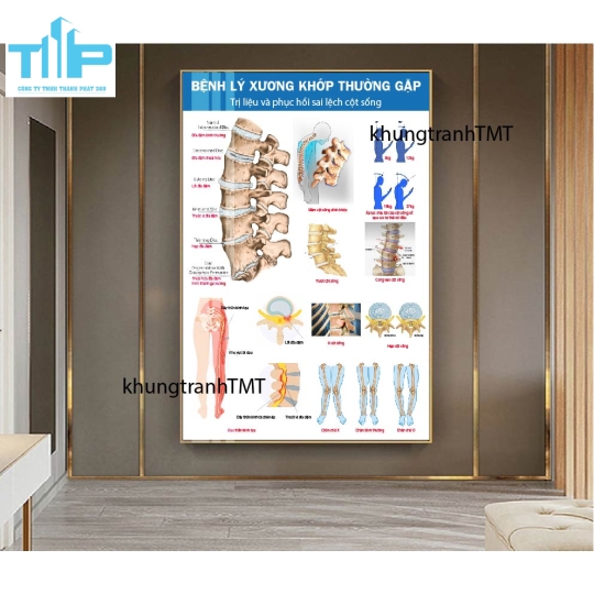 Tranh tráng gương hệ thần kinh và các bệnh lý thường gặp 