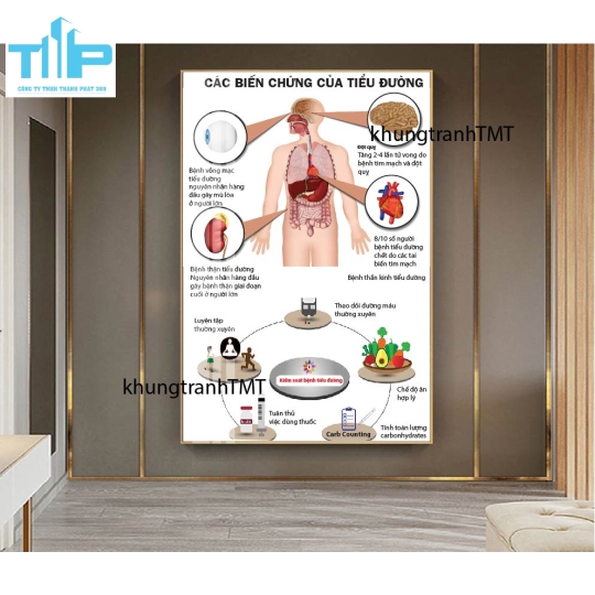 Tranh tráng gương hệ thần kinh và các bệnh lý thường gặp 