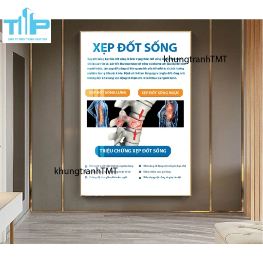 Tranh tráng gương hệ thần kinh và các bệnh lý thường gặp 