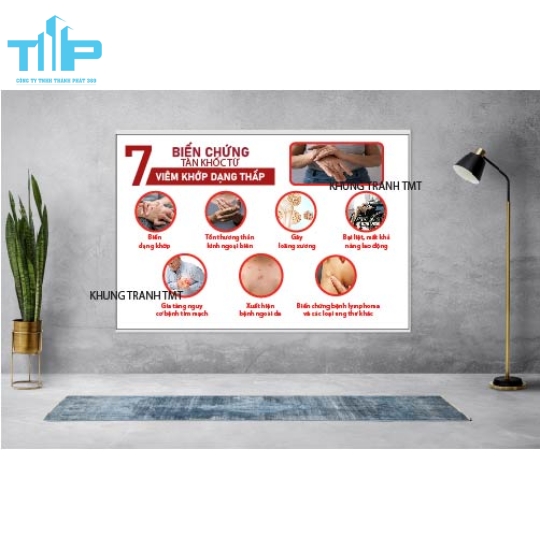 Tranh tráng gương hệ thần kinh và các bệnh lý thường gặp 
