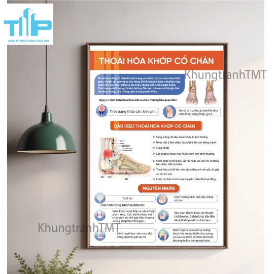 Tranh giải phẫu hệ xương, tủy sống - tráng gương sáng bóng, chống lóa