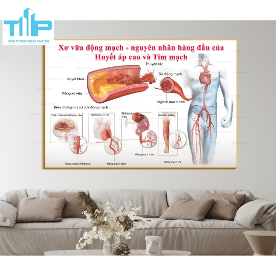 Khung tranh các bệnh về cơ xương khớp thường gặp P1