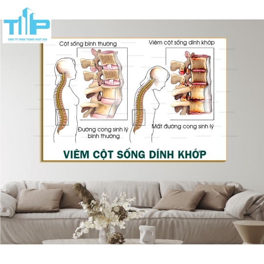 Khung tranh các bệnh về cơ xương khớp thường gặp P1