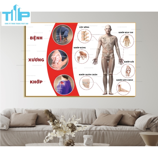 Khung tranh các bệnh về cơ xương khớp thường gặp P2