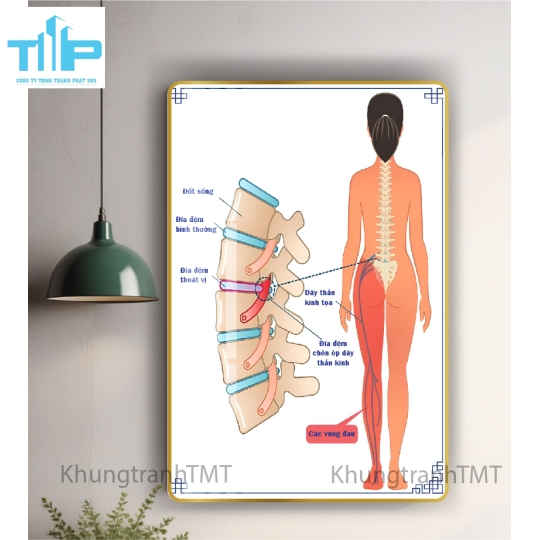 Khung tranh tráng gương - Dưỡng sinh điều trị đau cột sống, đốt sống cổ , vai gáy 