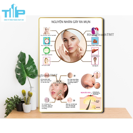 Khung tranh tráng gương  tiêm filler- meso