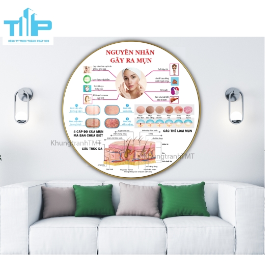 Khung tranh tráng gương- Tranh tròn Nguyên nhân nám tàn nhang