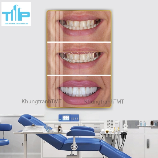 Khung tranh tráng gương - Các dịch vụ nha khoa thẩm mỹ