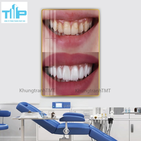 Khung tranh tráng gương - Các dịch vụ nha khoa thẩm mỹ