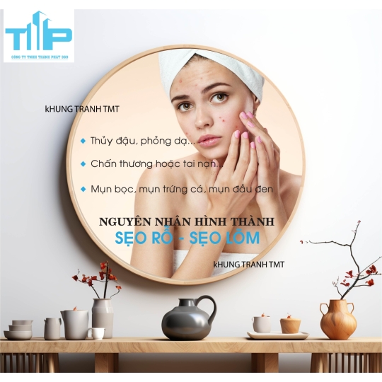 Khung tranh tráng gương - Tranh tròn - Điều trị mụn