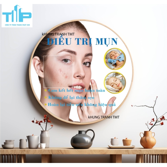 Khung tranh tráng gương - Tranh tròn - Điều trị mụn