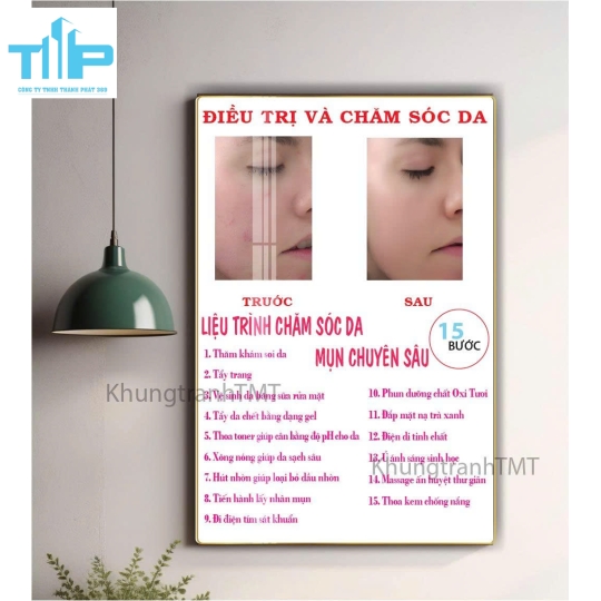 Tranh tráng gương các loại da thường gặp và nguyên nhân gây ra