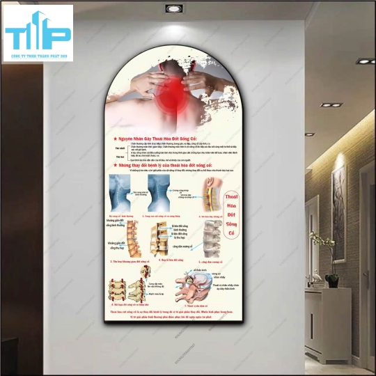 Tranh vòm gội đầu dưỡng sinh - Trị liệu xương khớp bằng phương pháp đông y
