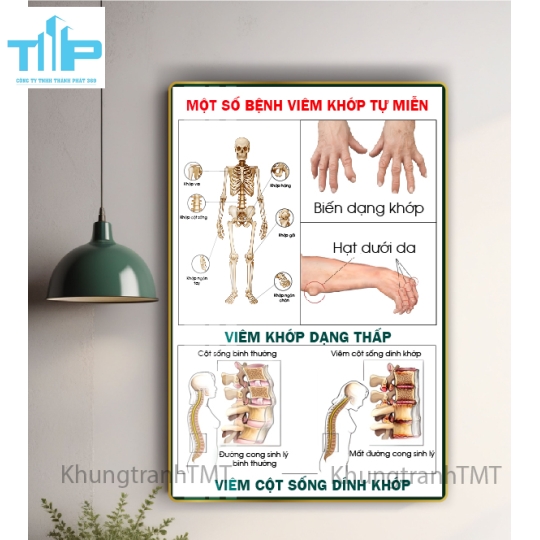 Khung tranh tráng gương huyệt đạo kinh lạc 