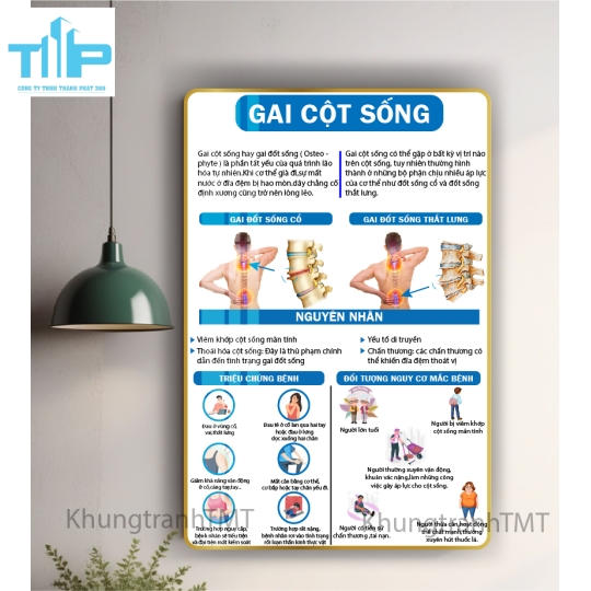 Tranh tráng gương tranh bấm huyệt đạo 