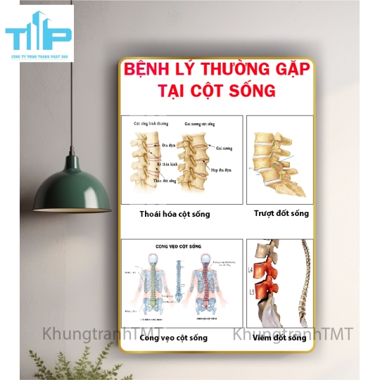 Tranh tráng gương tranh bấm huyệt đạo 