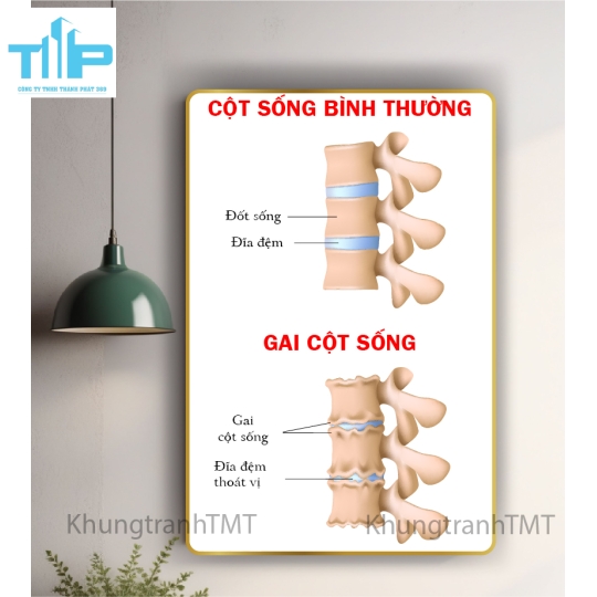 Tranh huyệt đạo đầu và cổ 