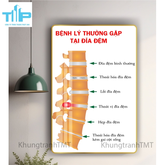 Tranh huyệt đạo đầu và cổ 