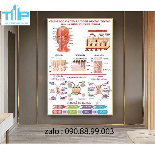 Tranh tráng gương filler - meso